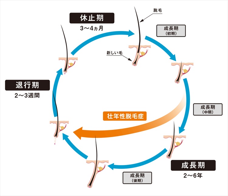 監修:東京女子医科大学 皮膚科 前教授・講座主任 川島 眞