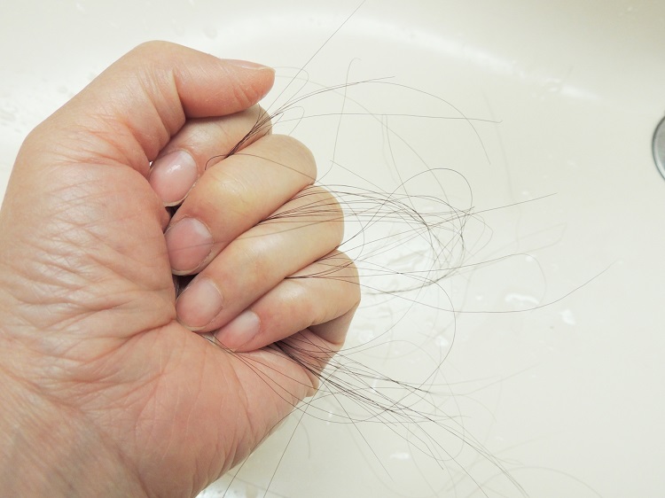 クリニック監修 抜け毛が多い その判断基準は 理由と対策は 薄毛 Aga治療のあれこれ Dクリニック福岡 旧城西クリニック福岡 の頭髪コラム
