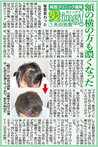 (2014/11/26)西編集1面